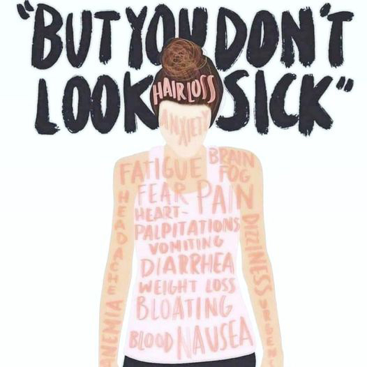 But you don’t look sick?