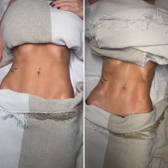 camofx drainage for lymphatic health